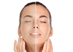 
                  
                    Stem Cell Facial System Includes: Two Complete Facials + Free 4oz Antioxidant Botanical Cleanser
                  
                