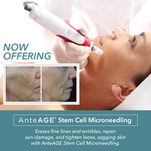 
                  
                    Anteage Stem Cell Micro-Needling
                  
                